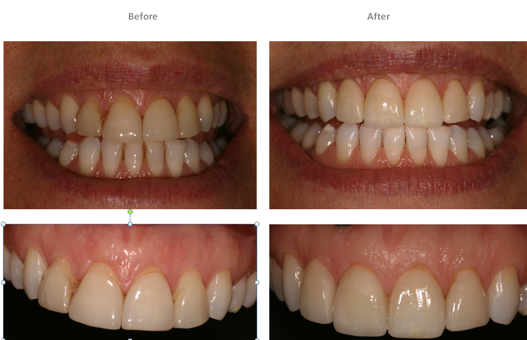 Aesthetic Dental Zone Smile Design