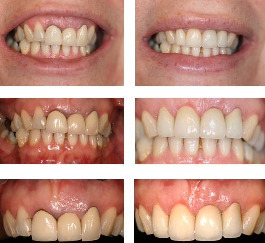 Aesthetic Dental Zone Smile Design