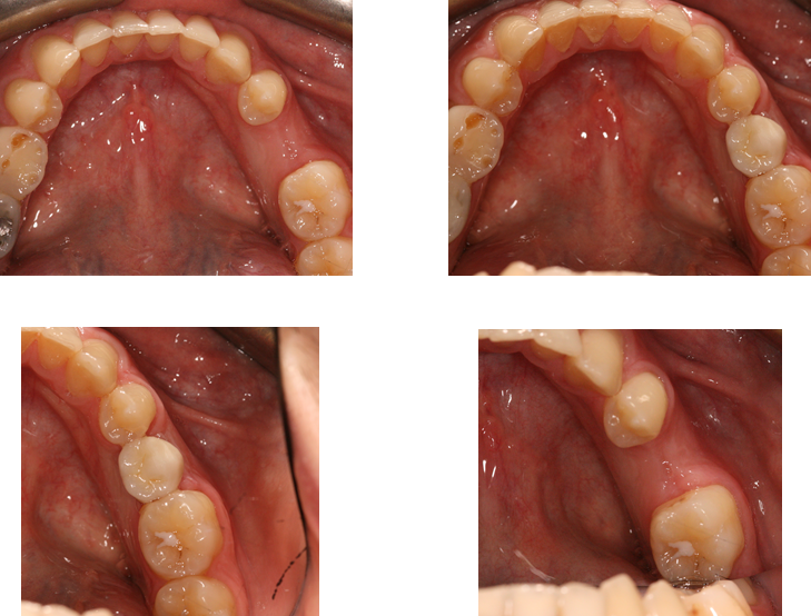 Aesthetic Dental Zone
