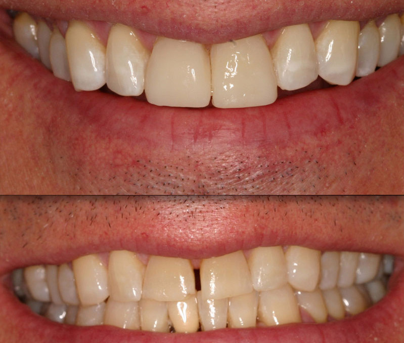 BioClear Aesthetic Dental Zone 4