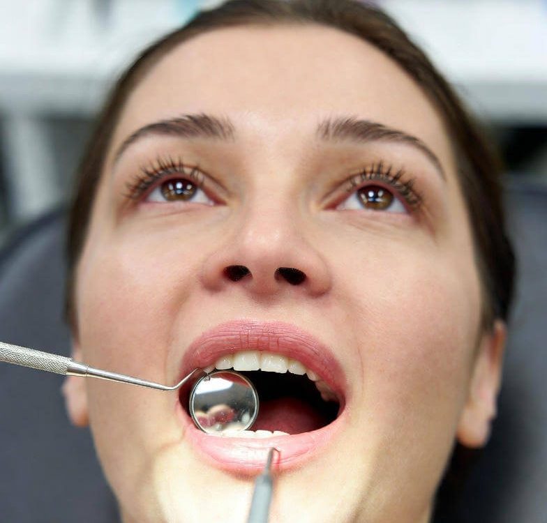 Smile Makeover Dulwich