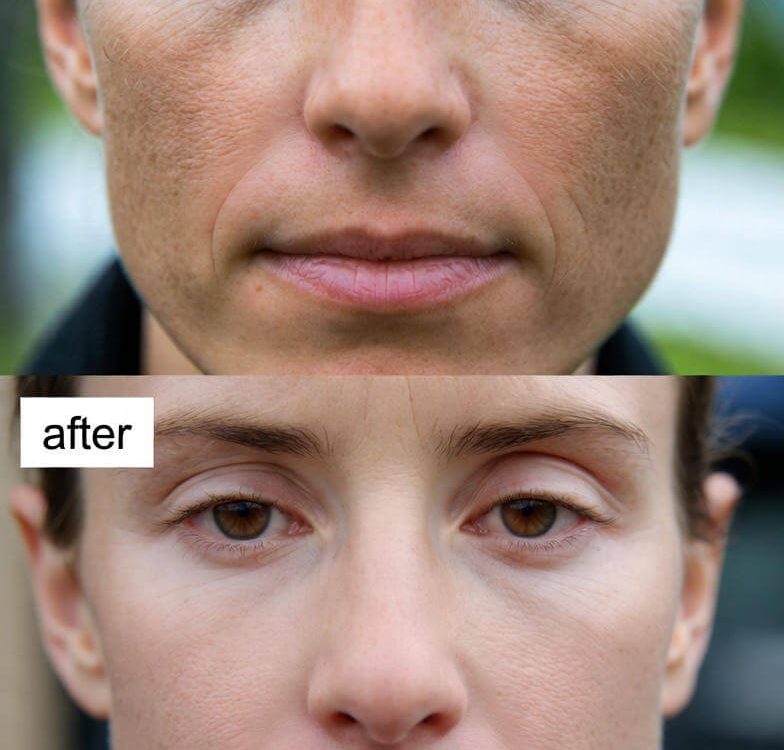 polynucleotide treatment