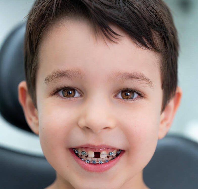 children orthodontics