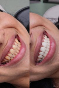 cosmetic dentistry