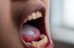 Flossing Teeth Smell: Causes, What It Means, and How to Fix It