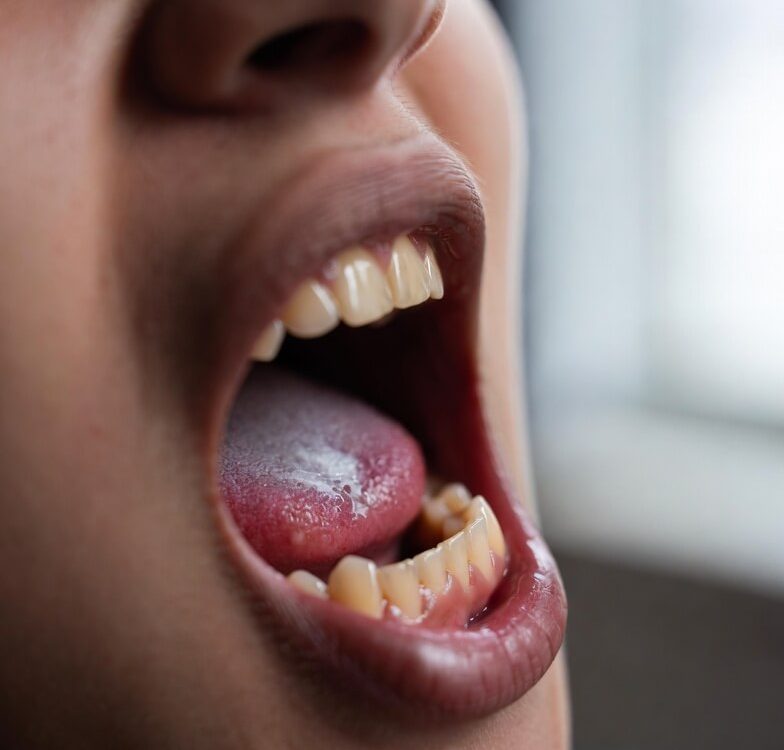 flossing teeth smell